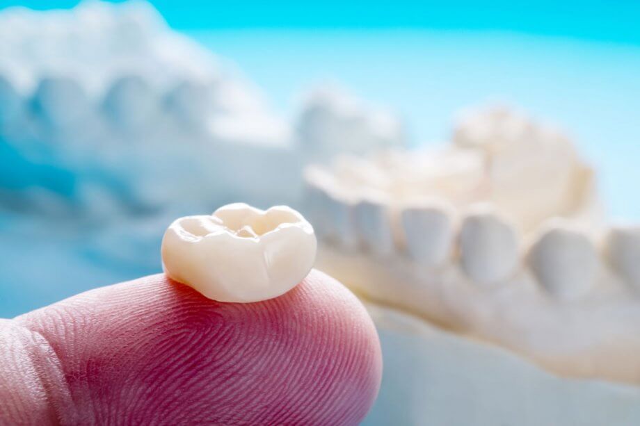 close up of dental crown on man's fingertip