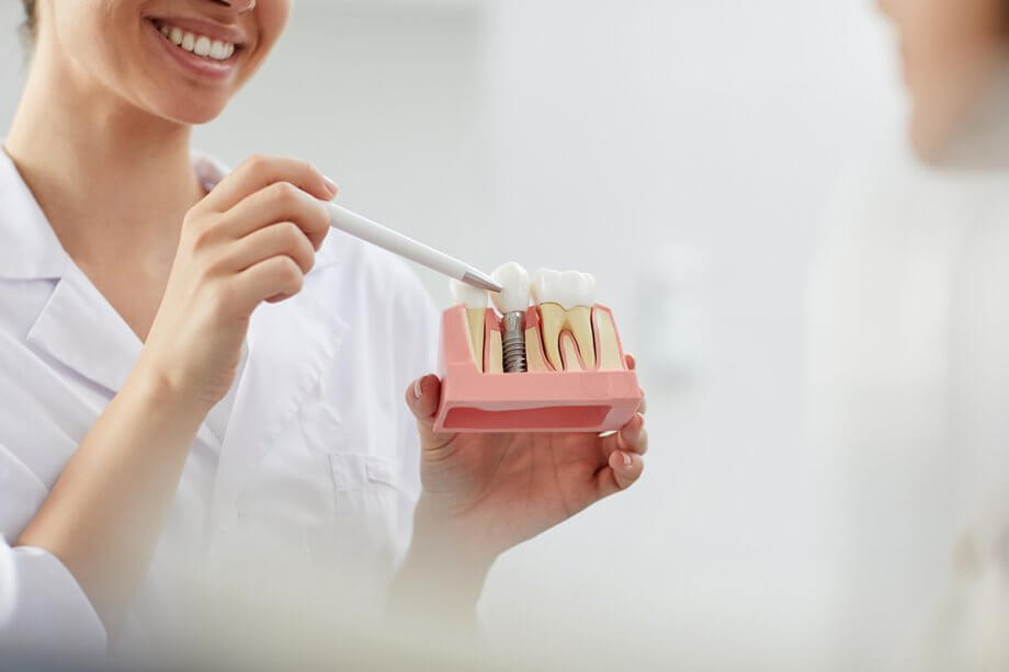 How Long Do Dental Implants Last?