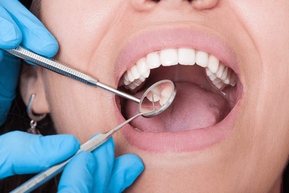 How Often Should You Get Your Teeth Cleaned?
